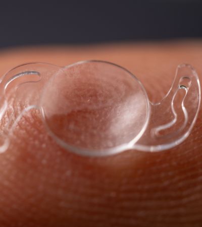 Cirurgia refractiva: soc candidat a LASIK o PRK?