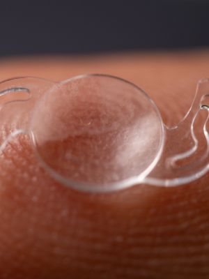 Cirugía refractiva: ¿soy candidato a LASIK o PRK?