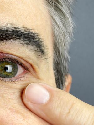 Blefaritis y orzuelos: 7 consejos útiles para evitar la inflamación de los párpados
