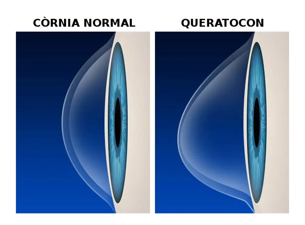 Còrnia