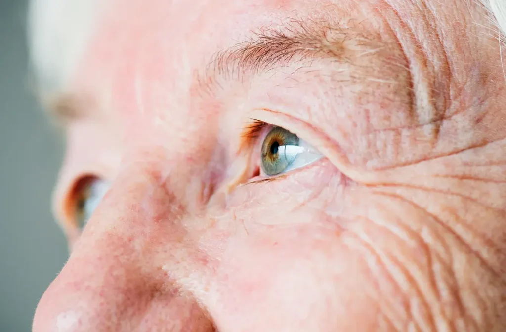 Degeneracio macular (DMAE): com detectar-la a temps i preservar la visio