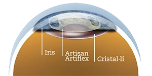 Artisan Artiflex
